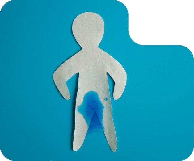Incontinência Urinária Masculina